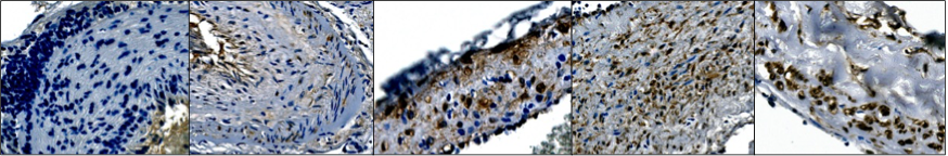 AG Neyazi_KCHN_UMMD_1